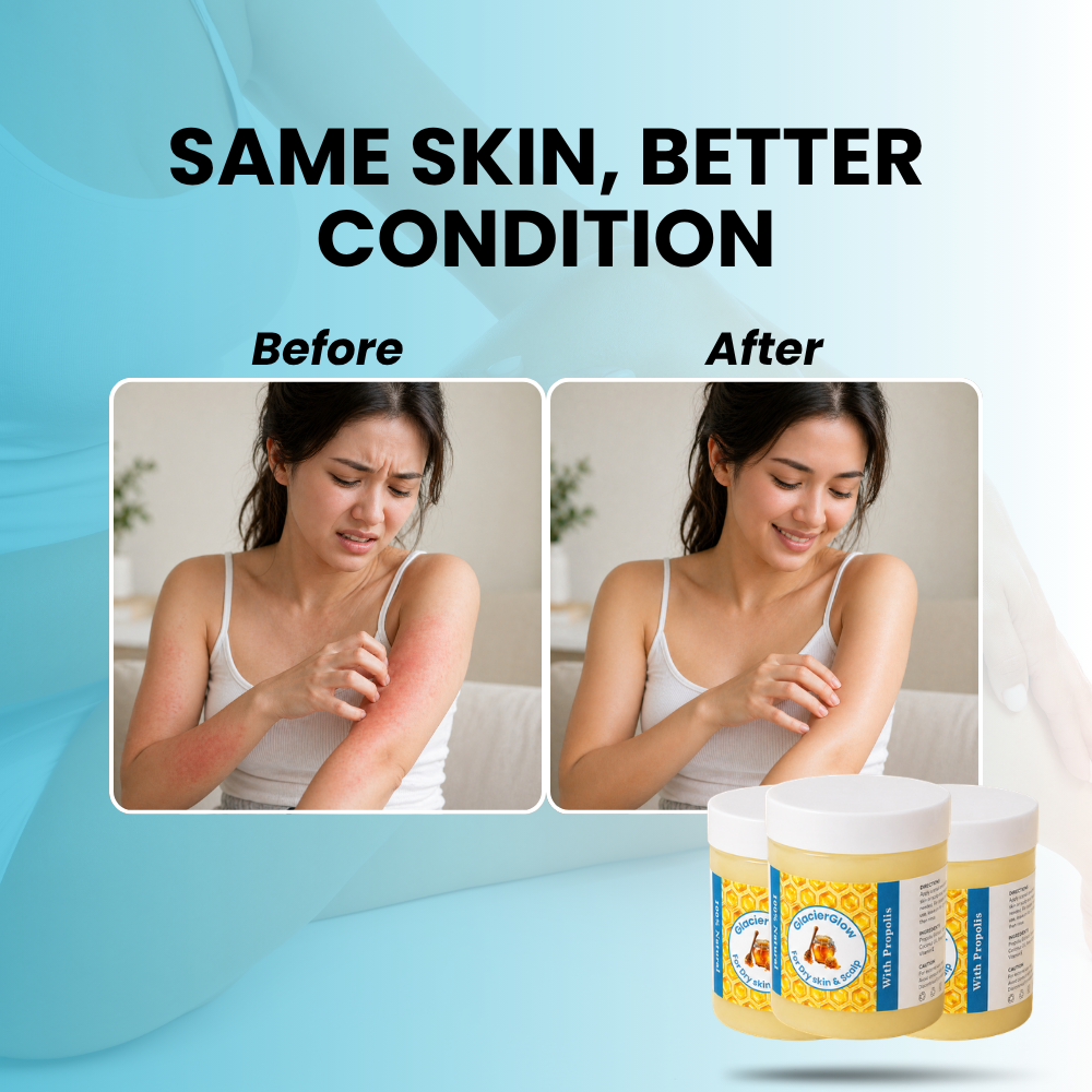 SmoothingSkin