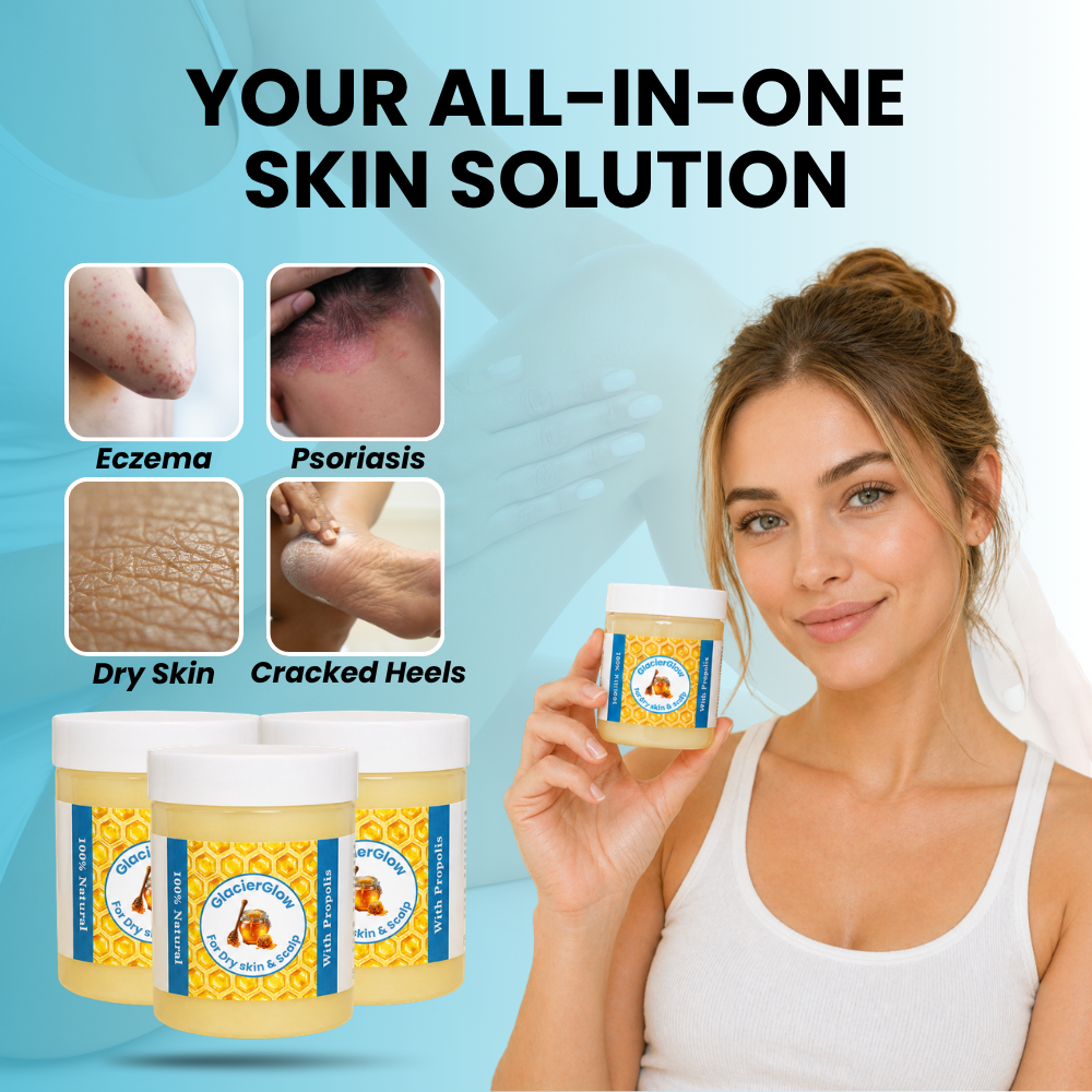 GlacierSkin - Repair Balm For Eczema & Psoriasis
