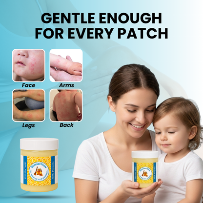 GlacierSkin - Steroid Free Balm For Children's Eczema